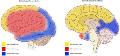 A Neuropsychological Rehabilitation Framework to Address Cognitive and Neurobehavioral Impairments After Strokes to the Anterior Communicating Artery